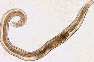 Parasites d'un homme de coupe