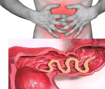 Parasites humains
