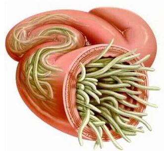 Symptômes et traitement des parasites humains