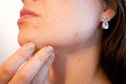 Problèmes de peau