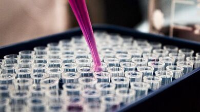 Comment passer des tests pour détecter les parasites dans le corps
